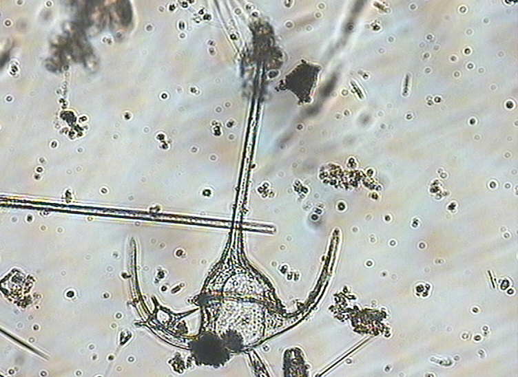 Dictyocha speculum